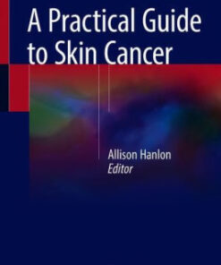 A Practical Guide to Skin Cancer by Allison Hanlon