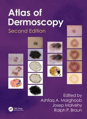 An Atlas of Dermoscopy 2nd Edition Ashfaq A. Marghoob