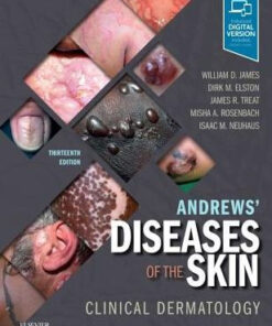 Andrews' Diseases of the Skin 13th Edition by William D. James