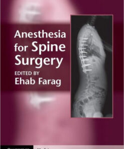 Anesthesia for Spine Surgery by Ehab Farag