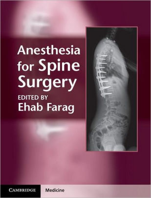 Anesthesia for Spine Surgery by Ehab Farag