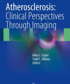 Atherosclerosis - Clinical Perspectives Through Imaging by Allen J Taylor