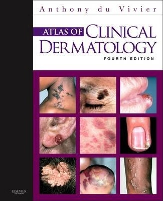 Atlas of Clinical Dermatology 4th Edition by Anthony Du Vivier