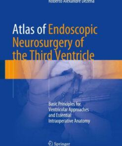 Atlas of Endoscopic Neurosurgery of the Third Ventricle by Dezena