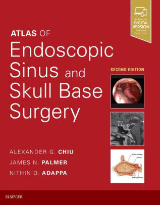 Atlas of Endoscopic Sinus and Skull Base Surgery 2nd Ed by Chiu