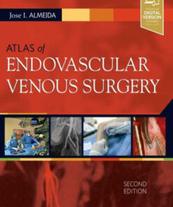 Atlas of Endovascular Venous Surgery 2nd Edition by Almeida