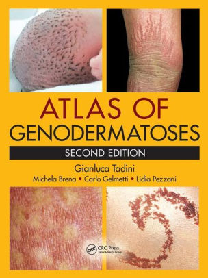 Atlas of Genodermatoses 2nd Edition by Gianluca Tadini