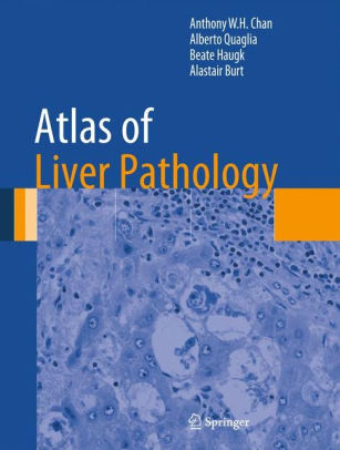 Atlas of Liver Pathology by Anthony W.H. Chan