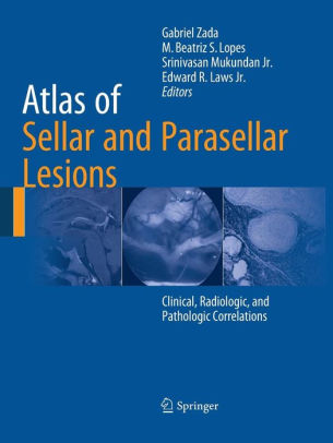 Atlas of Sellar and Parasellar Lesions by Gabriel Zada