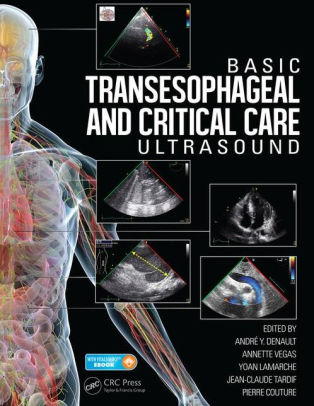 Basic Transesophageal and Critical Care Ultrasound by Andre Denault
