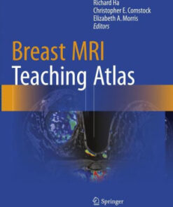 Breast MRI Teaching Atlas by Richard Ha