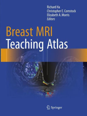 Breast MRI Teaching Atlas by Richard Ha