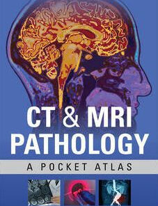 CT & MRI Pathology - A Pocket Atlas 3rd Edition by Ailinani