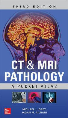 CT & MRI Pathology - A Pocket Atlas 3rd Edition by Ailinani