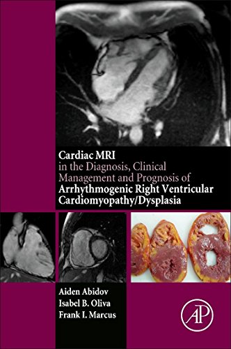 Cardiac MRI in Diagnosis