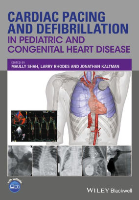 Cardiac Pacing and Defibrillation in Pediatric by Maully Shah