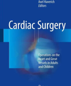 Cardiac Surgery - Operations on the Heart and Great Vessels by Gerhard Ziemer