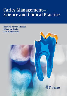 Caries Management - Science and Clinical Practice by Hendrik Meyer Lueckel