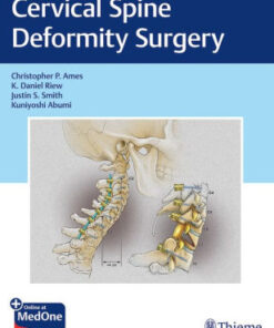 Cervical Spine Deformity Surgery by Christopher Ames