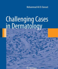 Challenging Cases in Dermatology by Mohammad Ali El Darouti