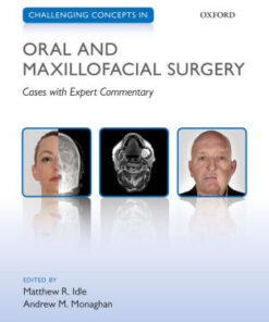 Challenging Concepts in Oral and Maxillofacial Surgery by Matthew Idle