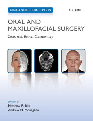 Challenging Concepts in Oral and Maxillofacial Surgery by Matthew Idle