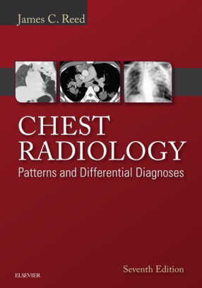 Chest Radiology 7th Edition by Reed