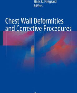 Chest Wall Deformities and Corrective Procedures by Shyam Kolvekar