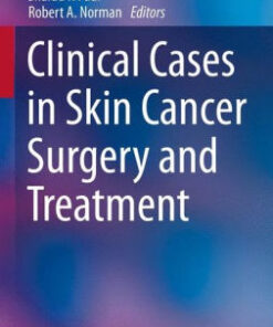 Clinical Cases in Skin Cancer Surgery and Treatment by Paul
