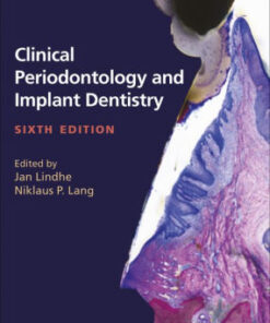 Clinical Periodontology and Implant Dentistry 2 Vol Set 6th Ed by Lang
