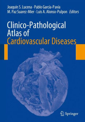 Clinico Pathological Atlas of Cardiovascular Diseases by Joaquïn S. Lucena