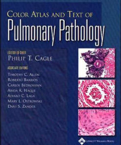 Color Atlas and Text of Pulmonary Pathology by Philip T. Cagle