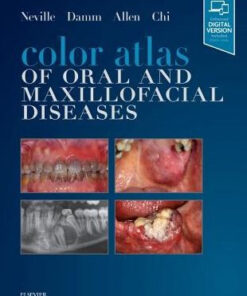 Color Atlas of Oral and Maxillofacial Diseases by Brad W. Neville