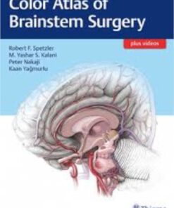 Color atlas of brainstem surgery by Spetzler