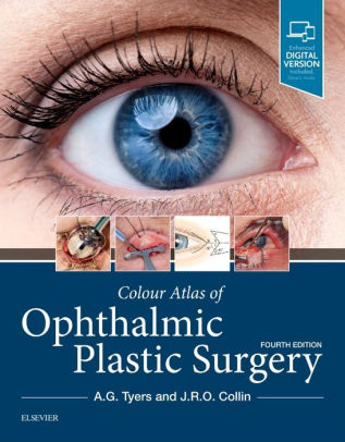 Colour Atlas of Ophthalmic Plastic Surgery 4th Edition by Tyers