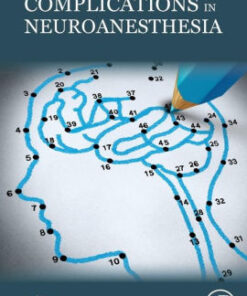 Complications in Neuroanesthesia by Prabhakar
