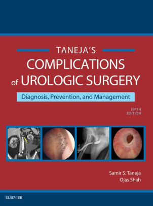 Complications of Urologic Surgery by Samir S. Taneja