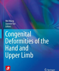 Congenital Deformities of the Hand and Upper Limb by Wang