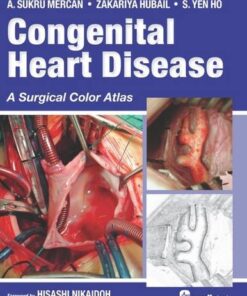 Congenital Heart Disease A Surgical Color Atlas By A. Sukru Mercan
