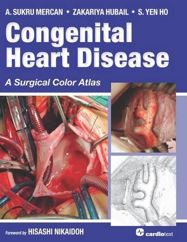 Congenital Heart Disease A Surgical Color Atlas By A. Sukru Mercan