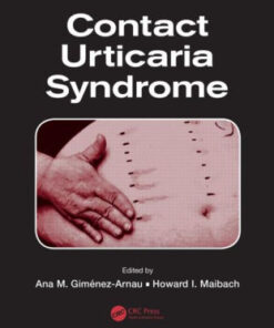 Contact Urticaria Syndrome by Ana M. Gimenez-Arnau