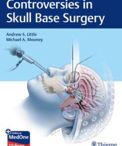 Controversies in Skull Base Surgery by Andrew S. Little