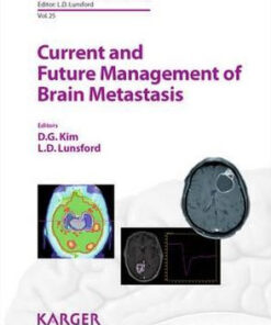 Current and Future Management of Brain Metastasis by D. G. Kim