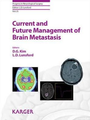 Current and Future Management of Brain Metastasis by D. G. Kim