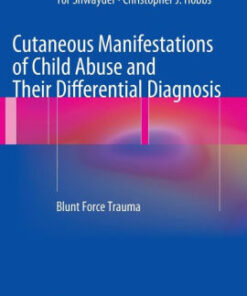 Cutaneous Manifestations of Child Abuse by Robert A.C. Bilo