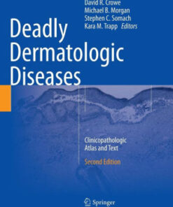 Deadly Dermatologic Diseases 2nd Edition by David R. Crowe