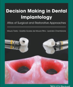 Decision Making in Dental Implantology by Mauro Tosta