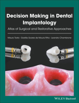 Decision Making in Dental Implantology by Mauro Tosta
