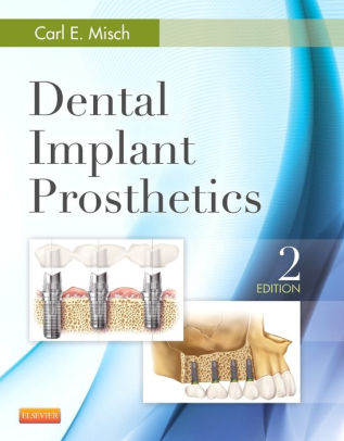 Dental Implant Prosthetics 2nd Edition by Carl E. Misch