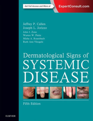 Dermatological Signs of Systemic Disease 5th Edition by Callen